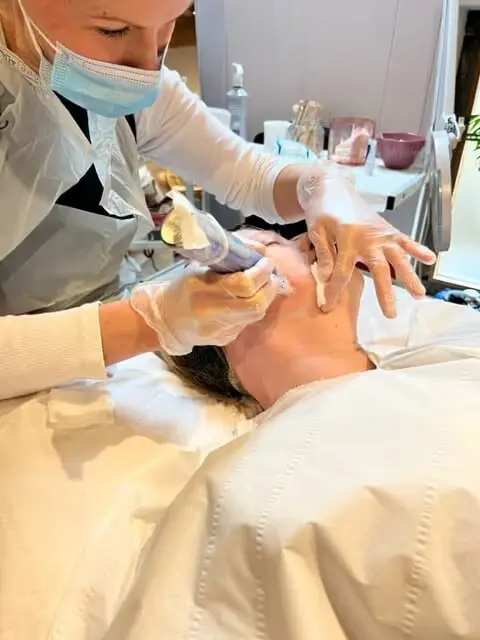 Skinpen nicroneedling